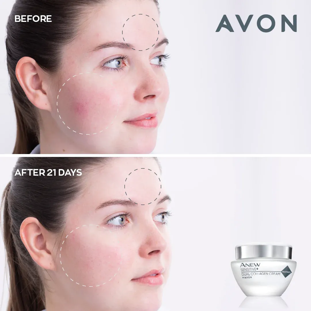 Avon Anew Sensitive  Dual Collagen Cream - 50ml