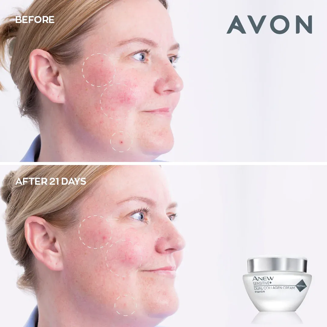 Avon Anew Sensitive  Dual Collagen Cream - 50ml