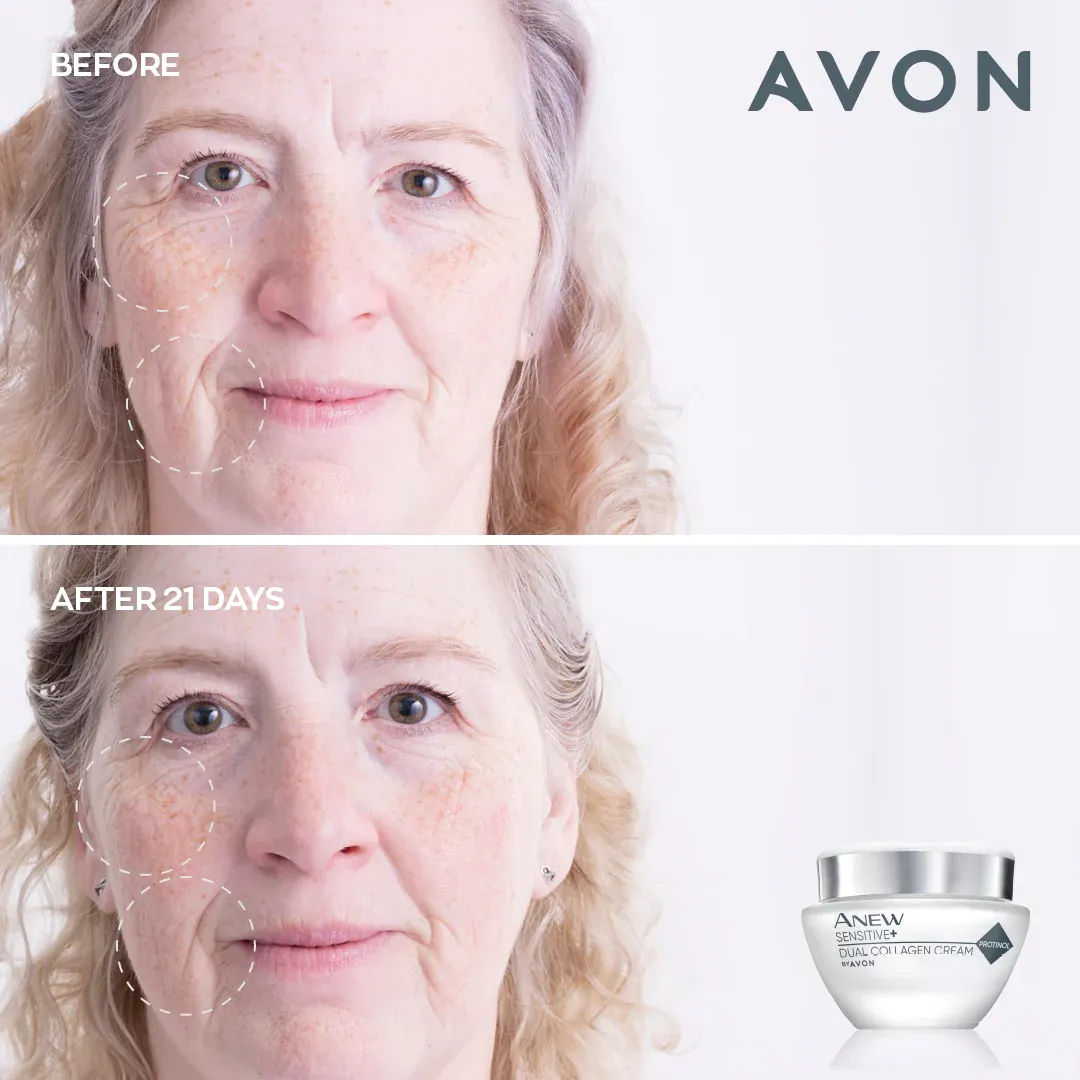 Avon Anew Sensitive  Dual Collagen Cream - 50ml