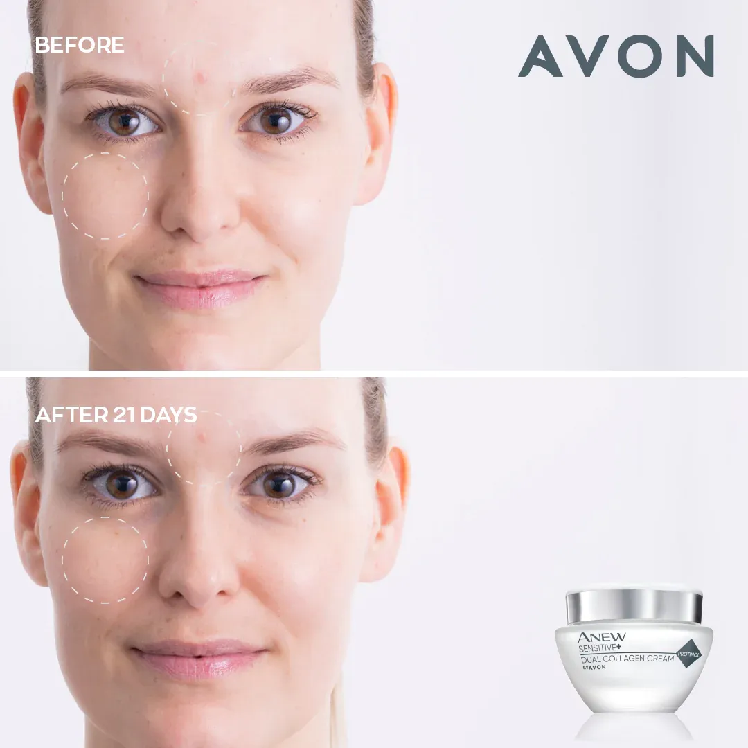 Avon Anew Sensitive  Dual Collagen Cream - 50ml