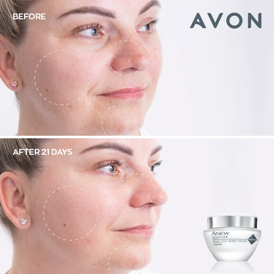 Avon Anew Sensitive  Dual Collagen Cream - 50ml