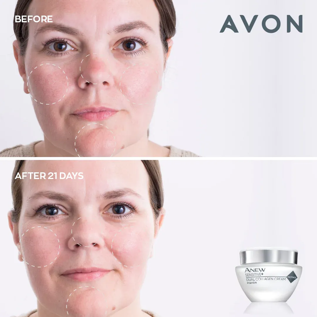 Avon Anew Sensitive  Dual Collagen Cream - 50ml