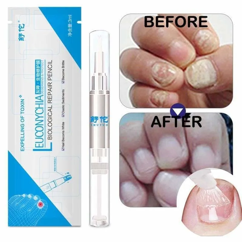 Fungal Nail Treatment Pen