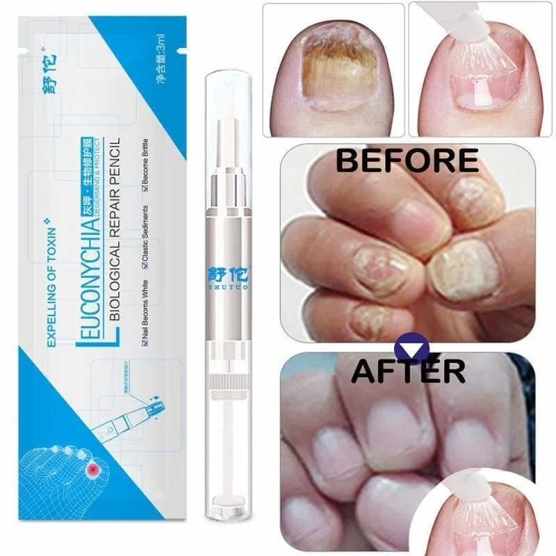 Fungal Nail Treatment Pen